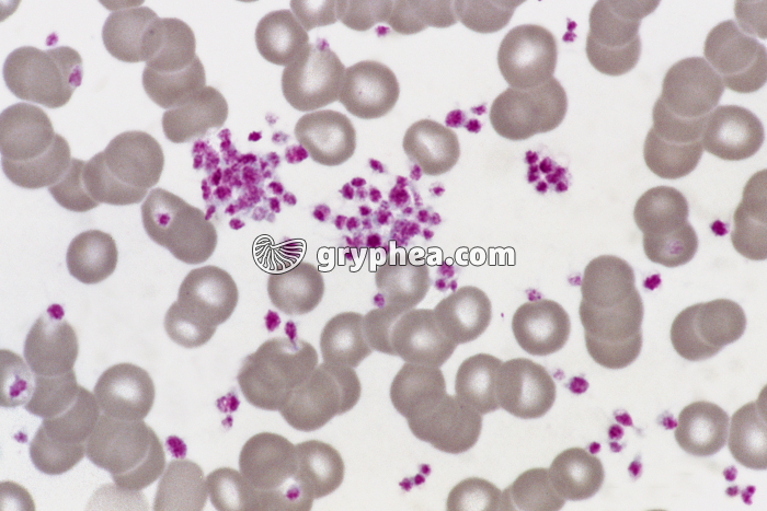 Plaquettes sanguines x400 - gryphea.org